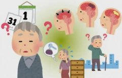 阿尔茨海默病治疗方法全指南：从早筛到长期管理，关键在“早”